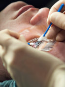 Pros and Cons of LASIK: Are the Risks Worth the Cost?