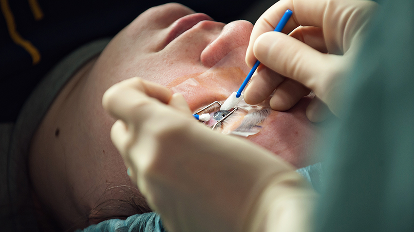 Can Everyone Have LASIK Surgery?
